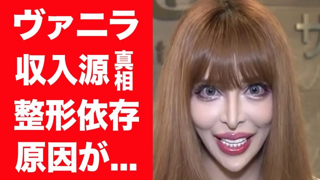 【驚愕】ヴァニラが整形依存症になってしまった理由や顔面崩壊した現在…整形にかけた総額に言葉を失った！『フランス人形』を目指す女性タレントの整形費用の収入源や大物タレントとの確執に絶句…！