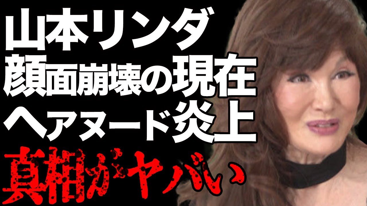山本リンダが多重整形で"顔面崩壊"した現在の姿…大物芸能人が"ヘアヌード"写真集を酷評して大炎上…「こまっちゃうナ」で有名な大物アーティストの旦那の正体と子供の実態に絶句…