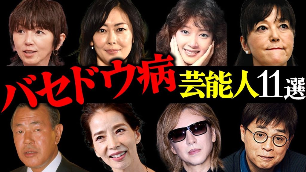 【衝撃】バセドウ病を罹患している芸能人11選