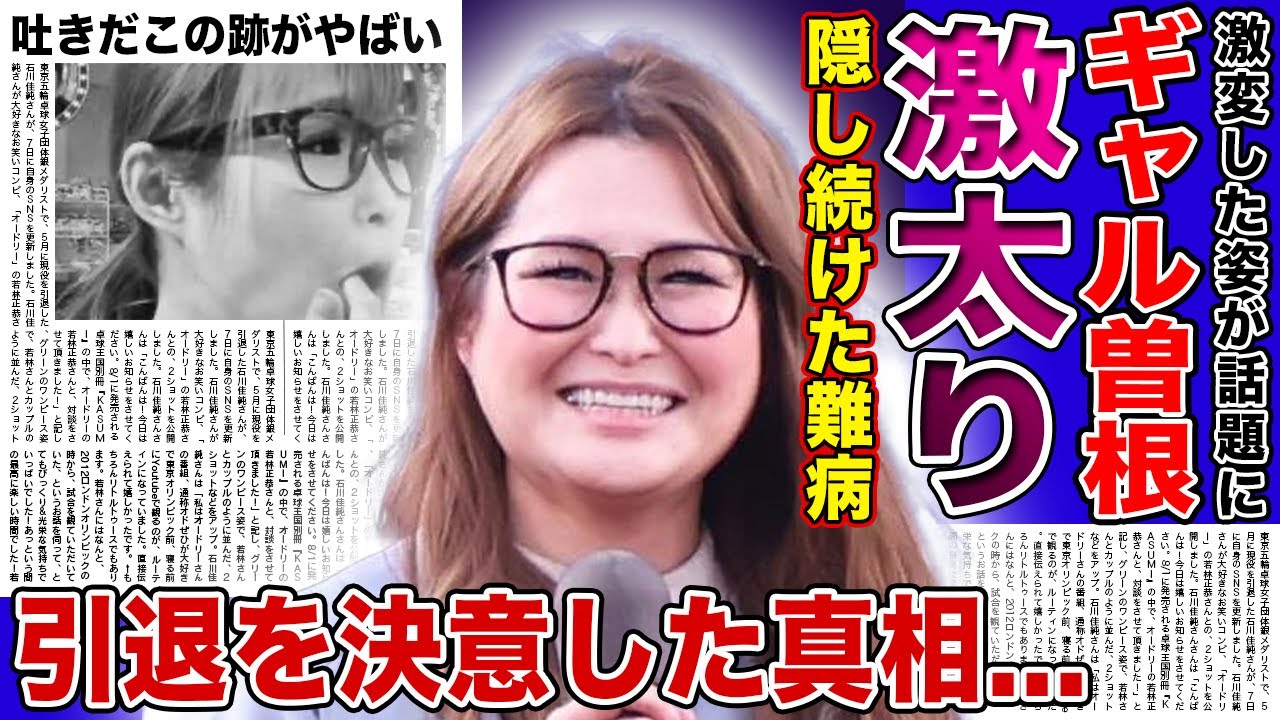 【衝撃】ギャル曽根が激太りした現在がやばすぎた...！！隠し続ける難病の真相...吐きだこがより一層ひどくなっている実態に驚きを隠せない！！芸能界を引退しようとしている現在とは
