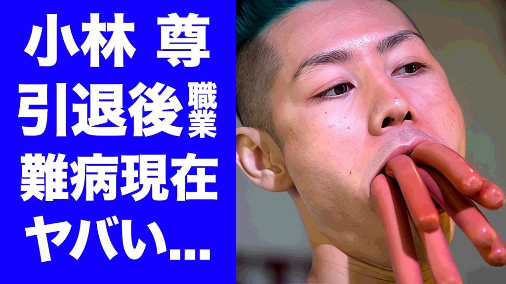 【衝撃】小林尊の引退後の職業...ステロイドで難病となった現在に驚きを隠せない...『大食いタレント』の巨額の年収...ギャル曽根との関係性に言葉を失う...