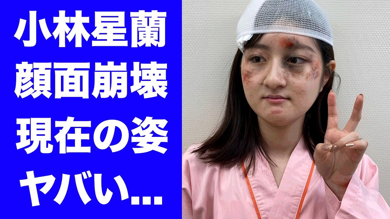 【衝撃】小林星蘭の顔面変形した変わり果てた現在の姿...クズ母のせいで芸能界から消された真相に驚きを隠せない...『名前をなくした女神』で有名な女優の家庭崩壊の実態に言葉を失う...