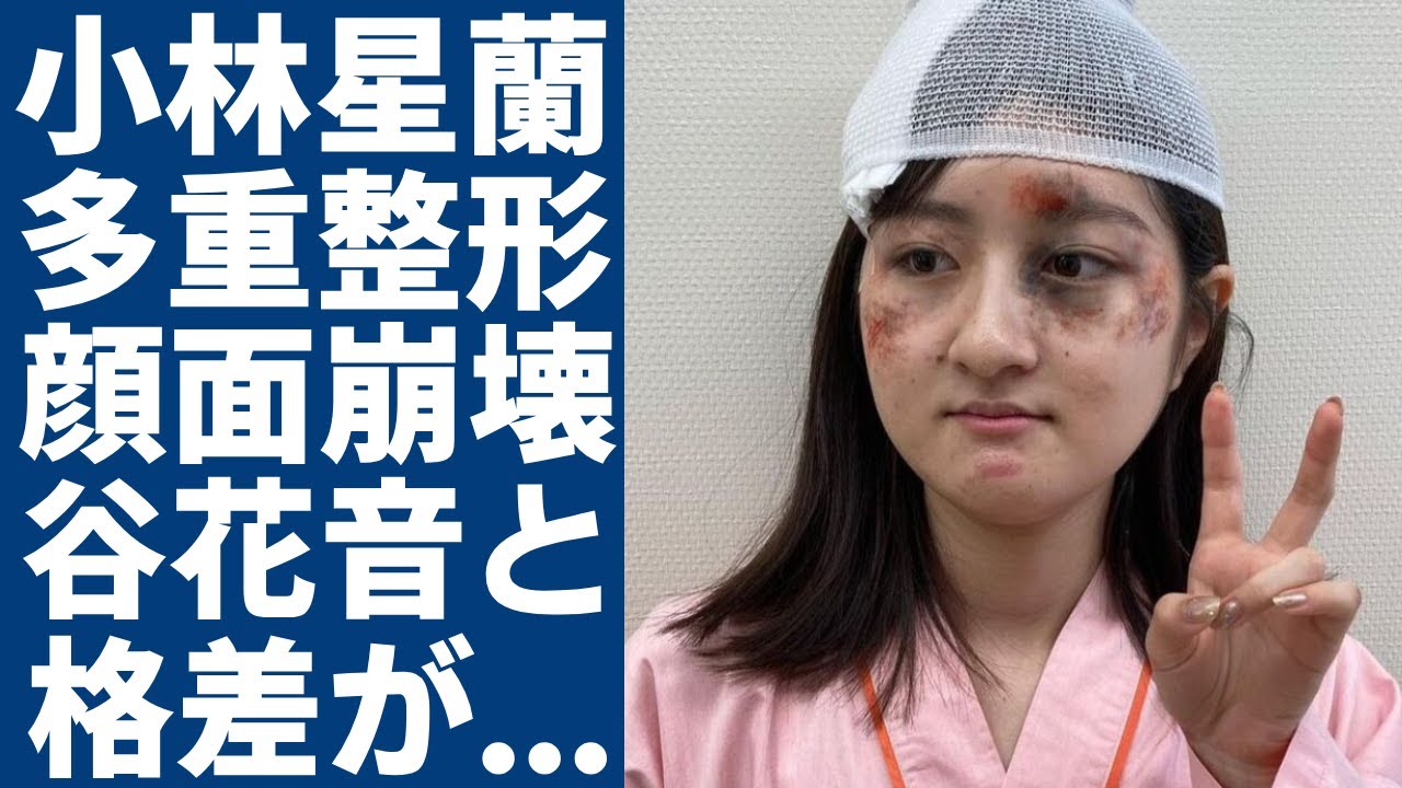 小林星蘭が激変した現在の姿...多重整形で顔面崩壊の真相に言葉を失う...子役として現在も活躍中の彼女が谷花音との格差がヤバい..母親が不倫女と言われる真相に驚きを隠さない...