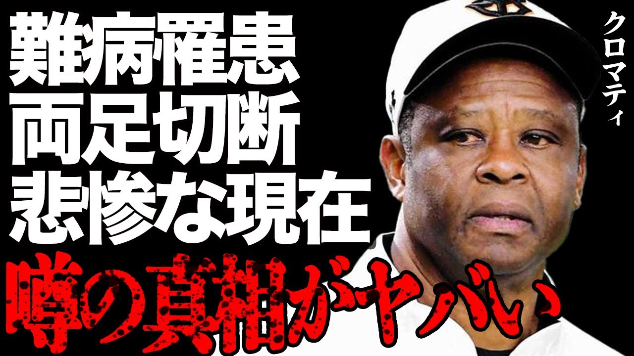クロマティの現在があまりにも悲惨すぎる衝撃の真相…難病になり下半身付随となった経緯に言葉を失う…元巨人の名選手が送っている日本での辛い生活に驚きを隠せない…